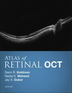 Atlas of Retinal OCT E-Book