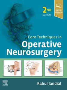 Core Techniques in Operative Neurosurgery