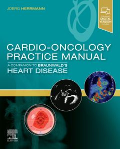 Cardio-Oncology Practice Manual: A Companion to Braunwald’s Heart Disease