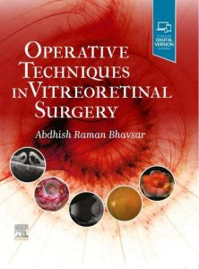 Operative Techniques in Vitreoretinal Surgery E-Book