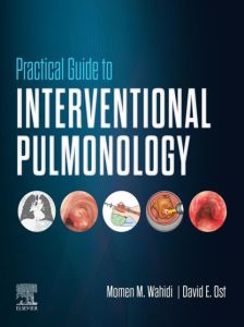 Practical Guide to Interventional Pulmonology E-Book