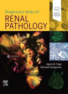 Diagnostic Atlas of Renal Pathology E-Book