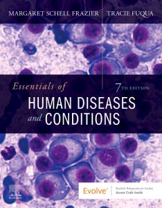 Essentials of Human Diseases and Conditions