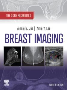 Breast Imaging, E-Book