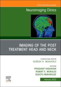 Imaging of the Post Treatment Head and Neck, An Issue of Neuroimaging Clinics of North America