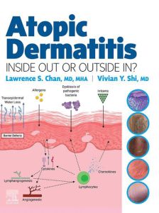 Atopic Dermatitis: Inside Out or Outside In - E-Book