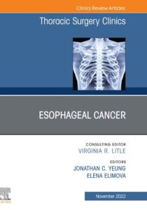 Esophageal Cancer,An Issue of Thoracic Surgery Clinics, E-Book