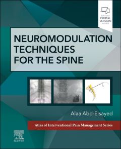 Neuromodulation Techniques for the Spine