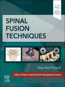 Spinal Fusion Techniques - E-Book