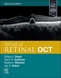 Atlas of Retinal OCT