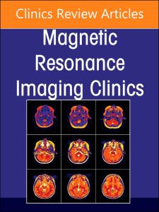 MR Imaging of the Adnexa, An Issue of Magnetic Resonance Imaging Clinics of North America