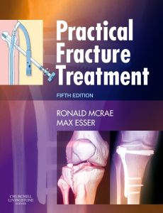 Practical Fracture Treatment