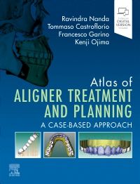 Atlas of Aligner Treatment and Planning