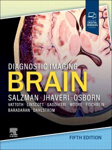Diagnostic Imaging: Brain