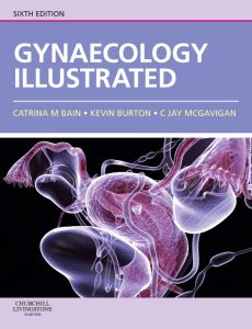 Gynaecology Illustrated