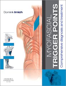 Myofascial Trigger Points