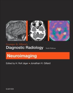 Grainger & Allison’s Diagnostic Radiology: Neuroimaging