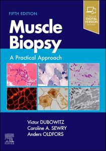 Muscle Biopsy