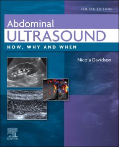 Abdominal Ultrasound