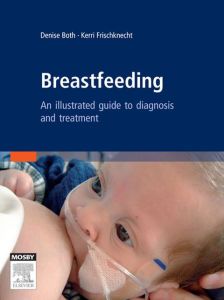 Breastfeeding - E-Book