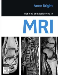 Planning and Positioning in MRI - E-Book
