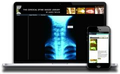 The Cervical Spine Image Bank