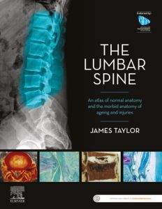 The Lumbar Spine - E-Book