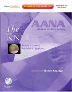 AANA Advanced Arthroscopy: The Knee