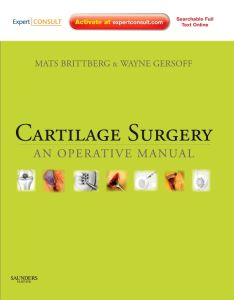 Cartilage Surgery