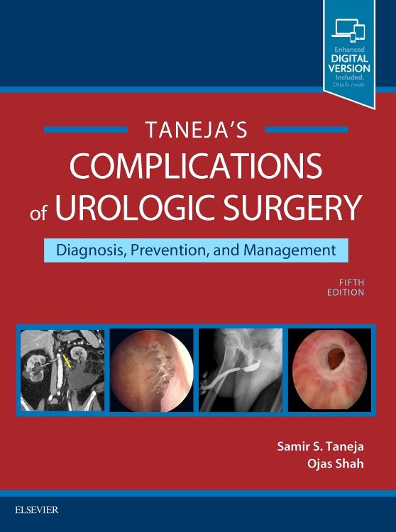 Complications of Urologic Surgery: 5th edition | Samir S. Taneja