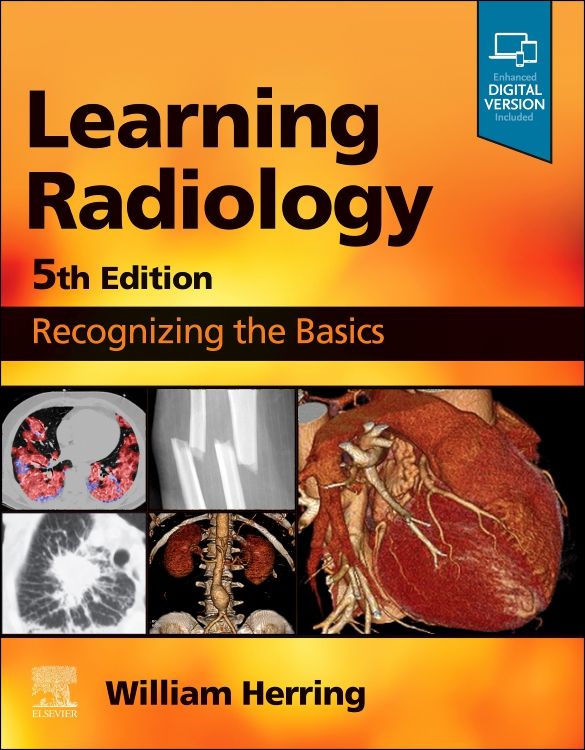 Learning Radiology 5th edition William Herring ISBN 9780323878173