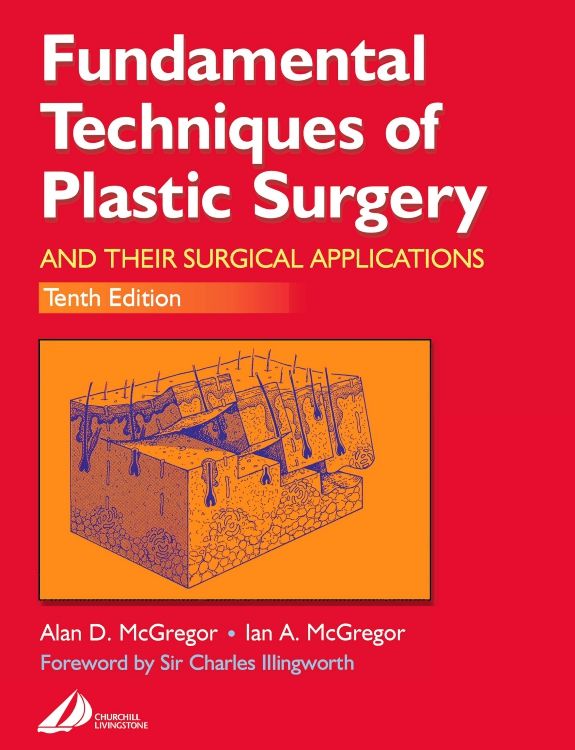 Fundamental Techniques of Plastic Surgery: 10th edition | Alan D