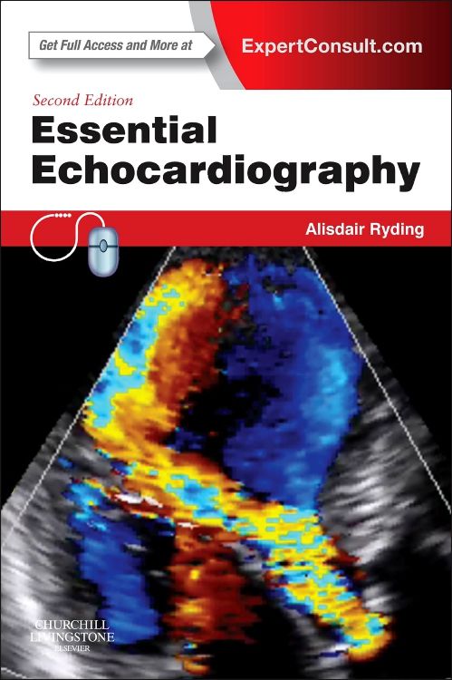 Essential Echocardiography: 2nd edition | Alisdair Ryding | ISBN