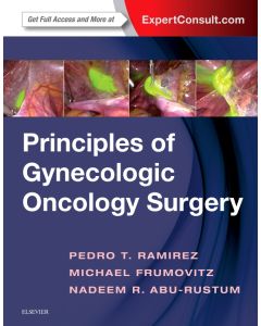 Principles of Gynecologic Oncology Surgery