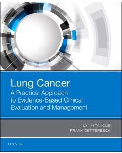 Lung Cancer: A Practical Approach to Evidence-Based Clinical Evaluation and Management