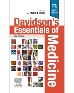 Davidson's Essentials of Medicine