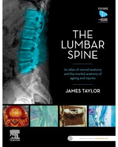 The Lumbar Spine