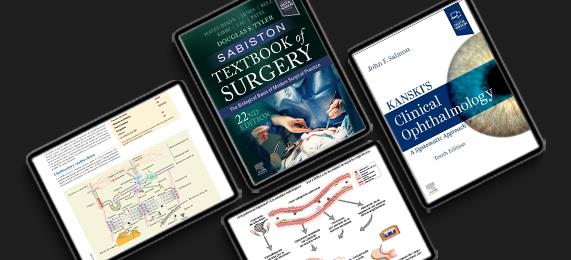 Elsevier eBooks. Knowledge on demand.